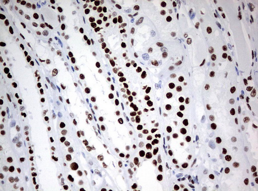 ZSCAN18 / ZNF447 Antibody - Immunohistochemical staining of paraffin-embedded Human Kidney tissue using anti-ZSCAN18 mouse monoclonal antibody.  heat-induced epitope retrieval by 10mM citric buffer, pH6.0, 120C for 3min)