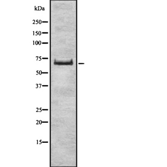 ZSCAN2 Antibody - Western blot analysis of ZSCAN2 expression in HEK293 cells. The lane on the left is treated with the antigen-specific peptide.