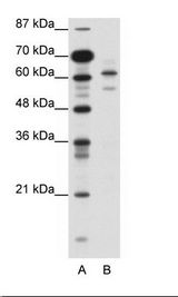ZSCAN2 Antibody - A: Marker, B: Jurkat Cell Lysate.  This image was taken for the unconjugated form of this product. Other forms have not been tested.