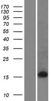 ZSCAN2 Protein - Western validation with an anti-DDK antibody * L: Control HEK293 lysate R: Over-expression lysate