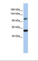 ZSCAN20 Antibody - Hela cell lysate. Antibody concentration: 1.0 ug/ml. Gel concentration: 6-18%.  This image was taken for the unconjugated form of this product. Other forms have not been tested.