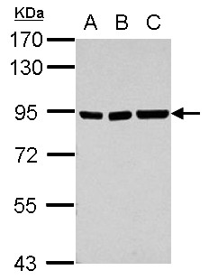 ZSCAN20 Antibody - Sample (30 ug of whole cell lysate) A: Jurkat B: Raji C: K562 7.5% SDS PAGE ZSCAN20 / ZNF31 antibody diluted at 1:5000