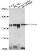 ZSCAN20 Antibody - Western blot analysis of extracts of various cell lines, using ZSCAN20 antibody at 1:1000 dilution. The secondary antibody used was an HRP Goat Anti-Rabbit IgG (H+L) at 1:10000 dilution. Lysates were loaded 25ug per lane and 3% nonfat dry milk in TBST was used for blocking. An ECL Kit was used for detection and the exposure time was 10s.