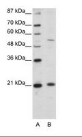 ZSCAN20 Antibody - A: Marker, B: HepG2 Cell Lysate.  This image was taken for the unconjugated form of this product. Other forms have not been tested.