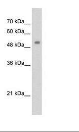ZSCAN21 / Zipro1 Antibody - Transfected 293T Cell Lysate.  This image was taken for the unconjugated form of this product. Other forms have not been tested.