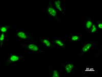 ZSCAN21 / Zipro1 Antibody - Immunostaining analysis in HeLa cells. HeLa cells were fixed with 4% paraformaldehyde and permeabilized with 0.1% Triton X-100 in PBS. The cells were immunostained with anti-ZNF38 mAb.