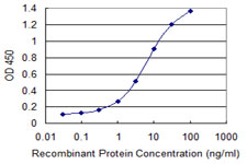ZSCAN21 / Zipro1 Antibody - Detection limit for recombinant GST tagged ZSCAN21 is 0.1 ng/ml as a capture antibody.