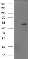 ZSCAN21 / Zipro1 Antibody - HEK293T cells were transfected with the pCMV6-ENTRY control (Left lane) or pCMV6-ENTRY ZSCAN21 (Right lane) cDNA for 48 hrs and lysed. Equivalent amounts of cell lysates (5 ug per lane) were separated by SDS-PAGE and immunoblotted with anti-ZSCAN21.