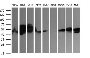 ZSCAN21 / Zipro1 Antibody - Western blot of extracts (35 ug) from 9 different cell lines by using anti-ZSCAN21 monoclonal antibody (HepG2: human; HeLa: human; SVT2: mouse; A549: human; COS7: monkey; Jurkat: human; MDCK: canine; PC12: rat; MCF7: human).
