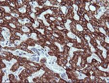 ZSCAN21 / Zipro1 Antibody - IHC of paraffin-embedded Human liver tissue using anti-ZSCAN21 mouse monoclonal antibody.