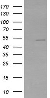 ZSCAN21 / Zipro1 Antibody - HEK293T cells were transfected with the pCMV6-ENTRY control (Left lane) or pCMV6-ENTRY ZSCAN21 (Right lane) cDNA for 48 hrs and lysed. Equivalent amounts of cell lysates (5 ug per lane) were separated by SDS-PAGE and immunoblotted with anti-ZSCAN21.
