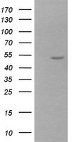 ZSCAN21 / Zipro1 Antibody - HEK293T cells were transfected with the pCMV6-ENTRY control (Left lane) or pCMV6-ENTRY ZSCAN21 (Right lane) cDNA for 48 hrs and lysed. Equivalent amounts of cell lysates (5 ug per lane) were separated by SDS-PAGE and immunoblotted with anti-ZSCAN21.