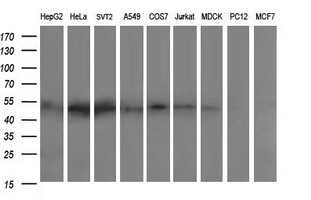 ZSCAN21 / Zipro1 Antibody - Western blot of extracts (35 ug) from 9 different cell lines by using anti-ZSCAN21 monoclonal antibody (HepG2: human; HeLa: human; SVT2: mouse; A549: human; COS7: monkey; Jurkat: human; MDCK: canine; PC12: rat; MCF7: human).