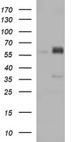 ZSCAN21 / Zipro1 Antibody - HEK293T cells were transfected with the pCMV6-ENTRY control (Left lane) or pCMV6-ENTRY ZSCAN21 (Right lane) cDNA for 48 hrs and lysed. Equivalent amounts of cell lysates (5 ug per lane) were separated by SDS-PAGE and immunoblotted with anti-ZSCAN21.