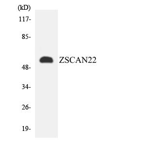 ZSCAN22 Antibody - Western blot analysis of the lysates from HepG2 cells using ZSCAN22 antibody.