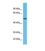 ZSCAN22 Antibody - Western blot of Human Breast Tumor. ZSCAN22 antibody dilution 1.0 ug/ml.  This image was taken for the unconjugated form of this product. Other forms have not been tested.