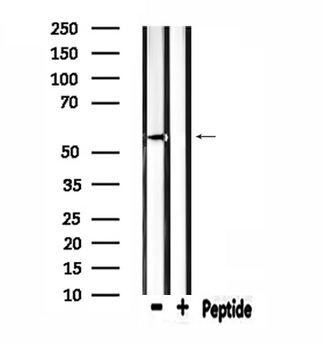 ZSCAN22 Antibody - Western blot analysis of extracts of rat brain tissue using ZSCAN22 antibody.