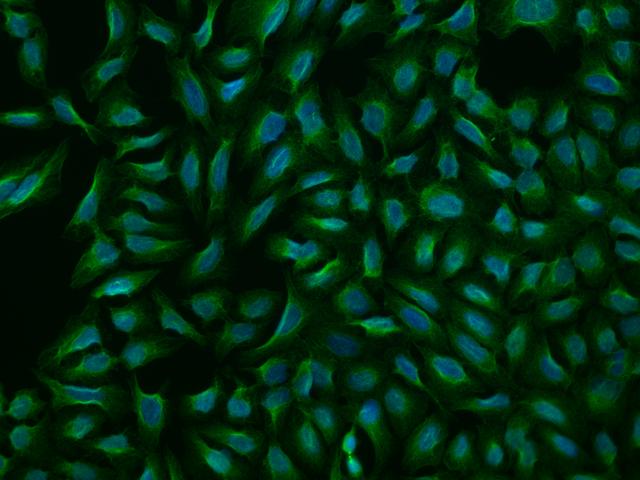 ZSCAN22 Antibody - Immunofluorescence staining of ZSCAN22 in U2OS cells. Cells were fixed with 4% PFA, permeabilzed with 0.1% Triton X-100 in PBS, blocked with 10% serum, and incubated with rabbit anti-Human ZSCAN22 polyclonal antibody (dilution ratio 1:200) at 4°C overnight. Then cells were stained with the Alexa Fluor 488-conjugated Goat Anti-rabbit IgG secondary antibody (green) and counterstained with DAPI (blue). Positive staining was localized to Cytoplasm.