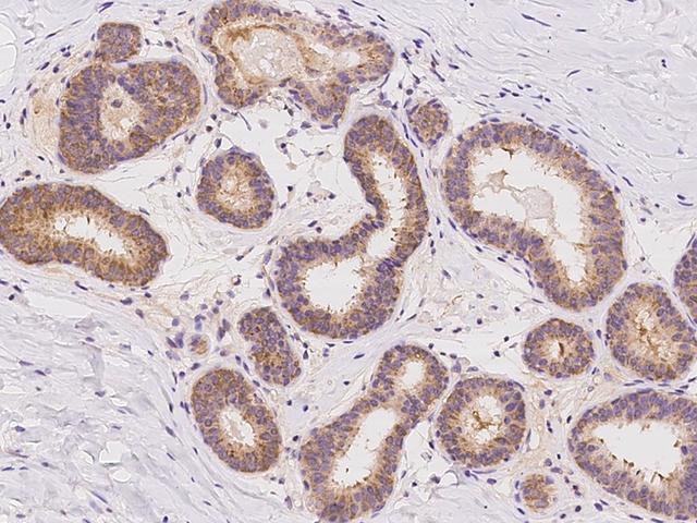 ZSCAN22 Antibody - Immunochemical staining of human ZSCAN22 in human breast with rabbit polyclonal antibody at 1:500 dilution, formalin-fixed paraffin embedded sections.