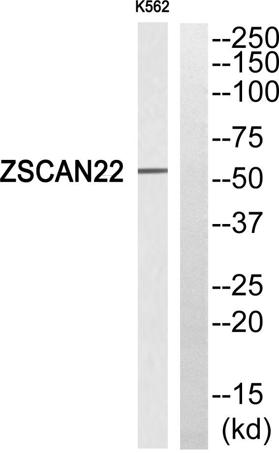 ZSCAN22 Antibody - Western blot analysis of extracts from K562 cells, using ZSCAN22 antibody.