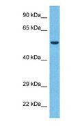 ZSCAN22 Antibody - Western blot of ZSC22 Antibody with human Fetal Liver lysate.  This image was taken for the unconjugated form of this product. Other forms have not been tested.