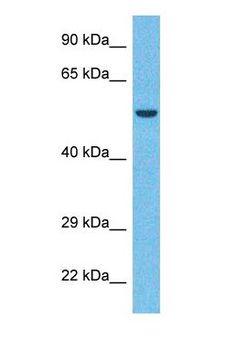 ZSCAN22 Antibody - Western blot of ZSC22 Antibody with human Fetal Liver lysate.  This image was taken for the unconjugated form of this product. Other forms have not been tested.