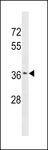 ZSCAN23 Antibody - ZSCAN23 Antibody western blot of HeLa cell line lysates (35 ug/lane). The ZSCAN23 antibody detected the ZSCAN23 protein (arrow).