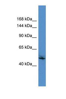 ZSCAN29 Antibody - Western blot of Human Jurkat. ZSCAN29 antibody dilution 1.0 ug/ml.  This image was taken for the unconjugated form of this product. Other forms have not been tested.