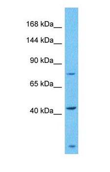 ZSCAN29 Antibody - Western blot of ZSC29 Antibody with human Fetal Liver lysate.  This image was taken for the unconjugated form of this product. Other forms have not been tested.