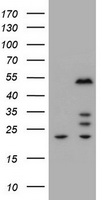 ZSCAN4 Antibody - HEK293T cells were transfected with the pCMV6-ENTRY control (Left lane) or pCMV6-ENTRY ZSCAN4 (Right lane) cDNA for 48 hrs and lysed. Equivalent amounts of cell lysates (5 ug per lane) were separated by SDS-PAGE and immunoblotted with anti-ZSCAN4.