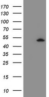 ZSCAN4 Antibody - HEK293T cells were transfected with the pCMV6-ENTRY control (Left lane) or pCMV6-ENTRY ZSCAN4 (Right lane) cDNA for 48 hrs and lysed. Equivalent amounts of cell lysates (5 ug per lane) were separated by SDS-PAGE and immunoblotted with anti-ZSCAN4.