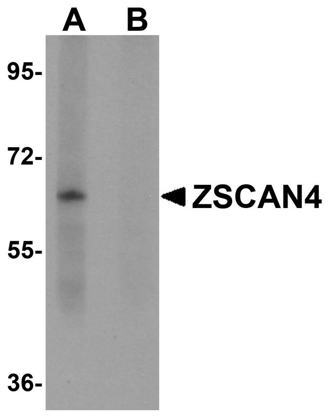 ZSCAN4 Antibody - Western blot analysis of ZSCAN4 in mouse lung tissue lysate with ZSCAN4 antibody in (A) the absence and (B) presence of peptide blocking.