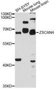 ZSCAN4 Antibody - Western blot analysis of extracts of various cell lines, using ZSCAN4 antibody at 1:3000 dilution. The secondary antibody used was an HRP Goat Anti-Rabbit IgG (H+L) at 1:10000 dilution. Lysates were loaded 25ug per lane and 3% nonfat dry milk in TBST was used for blocking. An ECL Kit was used for detection and the exposure time was 90s.