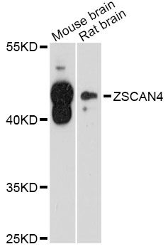 ZSCAN4 Antibody - Western blot analysis of extracts of rat brain, using ZSCAN4 antibody at 1:3000 dilution. The secondary antibody used was an HRP Goat Anti-Rabbit IgG (H+L) at 1:10000 dilution. Lysates were loaded 25ug per lane and 3% nonfat dry milk in TBST was used for blocking. An ECL Kit was used for detection and the exposure time was 90s.