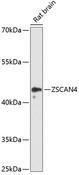 ZSCAN4 Antibody - Western blot analysis of extracts of rat brain using ZSCAN4 Polyclonal Antibody at dilution of 1:3000.