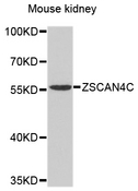 Zscan4c Antibody - Western blot analysis of extracts of mouse kidney, using ZSCAN4 antibody at 1:1000 dilution. The secondary antibody used was an HRP Goat Anti-Rabbit IgG (H+L) at 1:10000 dilution. Lysates were loaded 25ug per lane and 3% nonfat dry milk in TBST was used for blocking. An ECL Kit was used for detection and the exposure time was 90s.