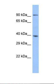 ZSCAN5 / ZSCAN5A Antibody - Western blot of Human Fetal Liver. ZSCAN5A antibody dilution 1.0 ug/ml.  This image was taken for the unconjugated form of this product. Other forms have not been tested.