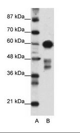 ZSCAN5 / ZSCAN5A Antibody - A: Marker, B: Transfected 293T Cell Lysate.  This image was taken for the unconjugated form of this product. Other forms have not been tested.