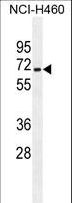 ZSCAN5B Antibody - ZSCAN5B Antibody western blot of NCI-H460 cell line lysates (35 ug/lane). The ZSCAN5B antibody detected the ZSCAN5B protein (arrow).