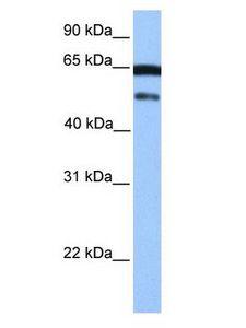 ZSCAN5B Antibody - ZSCAN5B antibody Western Blot of NTERA2 cell lysate.  This image was taken for the unconjugated form of this product. Other forms have not been tested.