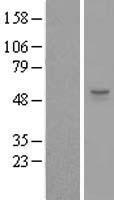 ZSWIM1 Protein - Western validation with an anti-DDK antibody * L: Control HEK293 lysate R: Over-expression lysate