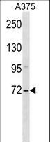 ZSWIM2 Antibody - ZSWIM2 Antibody western blot of A375 cell line lysates (35 ug/lane). The ZSWIM2 antibody detected the ZSWIM2 protein (arrow).