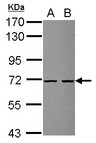 ZSWIM2 Antibody - Sample (30 ug of whole cell lysate) A: U87-MG B: MCF-7 7.5% SDS PAGE ZSWIM2 antibody diluted at 1:1000