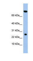 ZSWIM3 Antibody - ZSWIM3 antibody Western blot of DU145 cell lysate. This image was taken for the unconjugated form of this product. Other forms have not been tested.