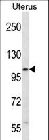 ZSWIM5 Antibody - ZSWIM5 Antibody western blot of human normal Uterus tissue lysates (35 ug/lane). The ZSWIM5 antibody detected the ZSWIM5 protein (arrow).