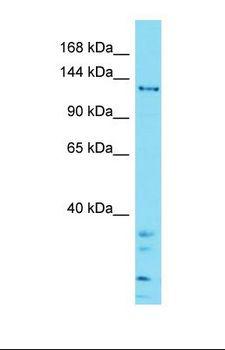 ZSWIM5 Antibody - Western blot of Human Jurkat. ZSWIM5 antibody dilution 1.0 ug/ml.  This image was taken for the unconjugated form of this product. Other forms have not been tested.