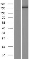 ZSWIM5 Protein - Western validation with an anti-DDK antibody * L: Control HEK293 lysate R: Over-expression lysate