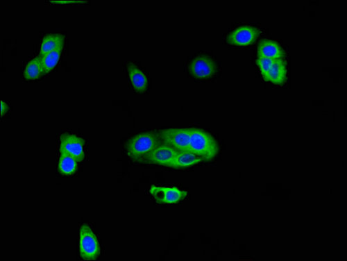 ZSWIM6 Antibody - Immunofluorescent analysis of HepG2 cells using ZSWIM6 Antibody at a dilution of 1:100 and Alexa Fluor 488-congugated AffiniPure Goat Anti-Rabbit IgG(H+L)