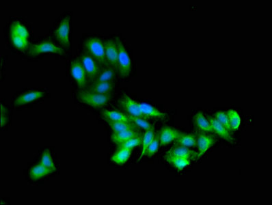 ZSWIM6 Antibody - Immunofluorescent analysis of HepG2 cells using ZSWIM6 Antibody at dilution of 1:100 and Alexa Fluor 488-congugated AffiniPure Goat Anti-Rabbit IgG(H+L)