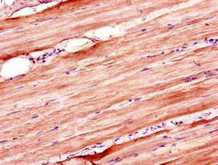 ZSWIM6 Antibody - Immunohistochemistry of paraffin-embedded human skeletal muscle tissue using ZSWIM6 Antibody at dilution of 1:100